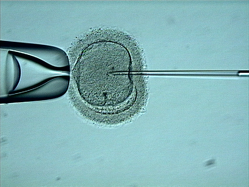 IVF-treatment.jpg